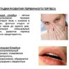 Лечение герпеса - особенности