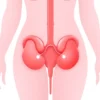A calm, clean medical illustration showing a female urinary system with focus on the bladder, depicting mild inflammation in soft red tones, no text or labels, realistic but simplified style, suitable for patient education