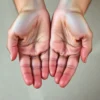 A close-up of hands with visible sweat droplets on the palms, showing mild discomfort, on a neutral background, soft natural lighting, realistic skin texture, no accessories or jewelry